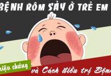 Các cách điều trị rôm sảy ở trẻ em cực hiệu quả bệnh rôm sảy ở trẻ em