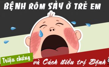 Các cách điều trị rôm sảy ở trẻ em cực hiệu quả bệnh rôm sảy ở trẻ em